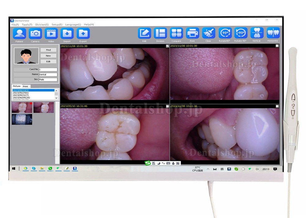 Magenta YF-2400P 歯科口腔内カメラ 24 インチ タッチスクリーン (WIFI 付き)